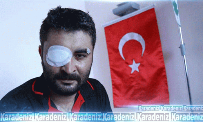 Kasıtlı olarak kurşun sıktılar!