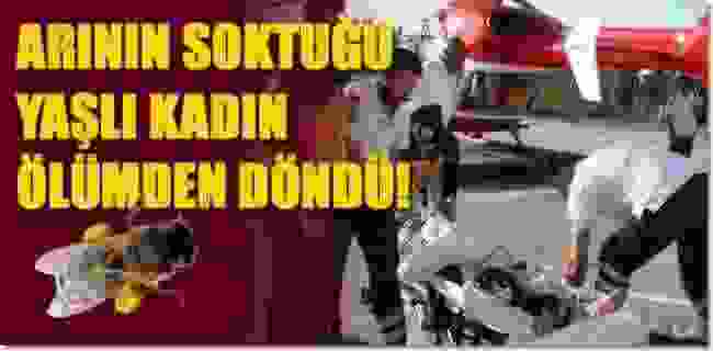 Arı Soktu Ölümden Döndü!