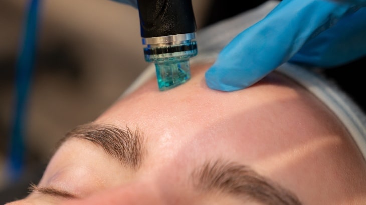 Hydrafacial Nasıl Uygulanıyor?