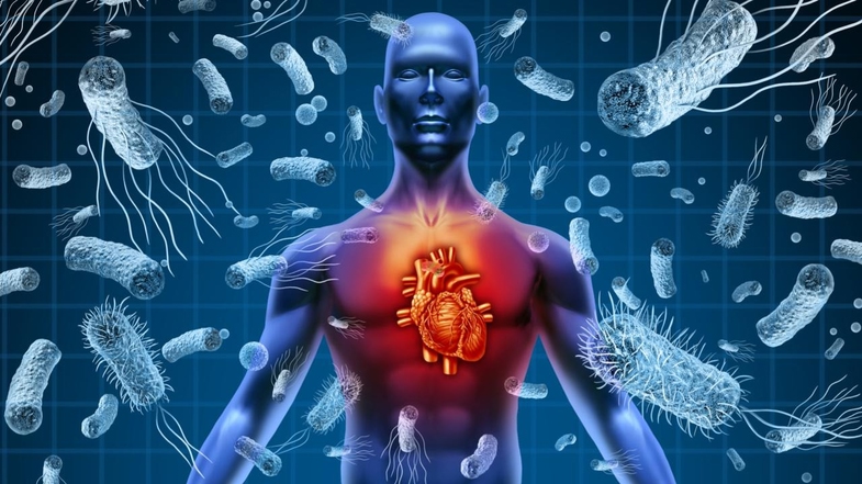 Çoklu Organ Yetmezliğinin Nedenleri